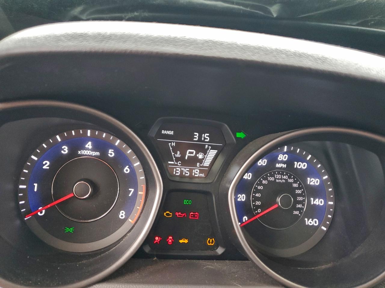 Hyundai ELANTRA Se Image 12